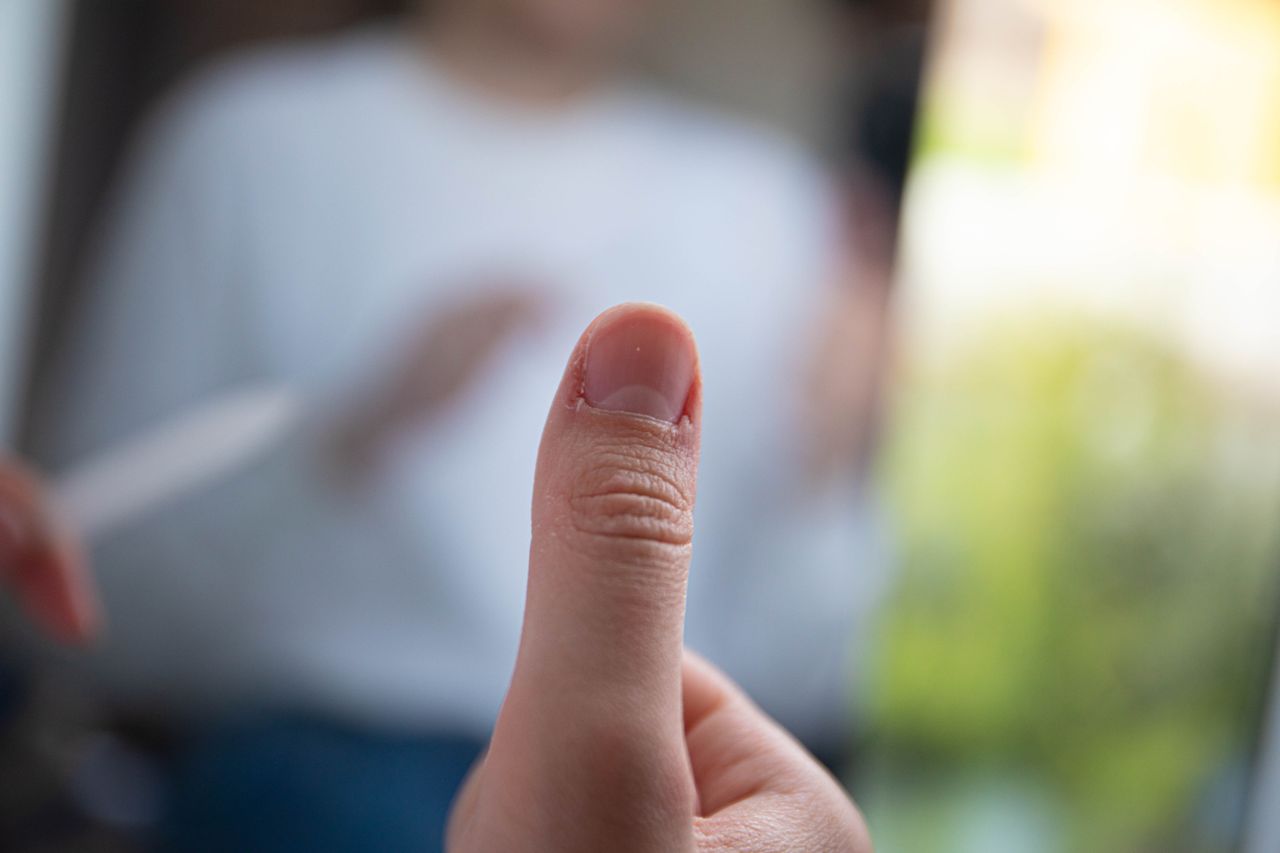 What Causes Brittle Nails and How Can You Protect Them?